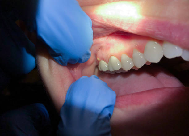 Best Emergency Cosmetic Dentistry in Pennville, PA