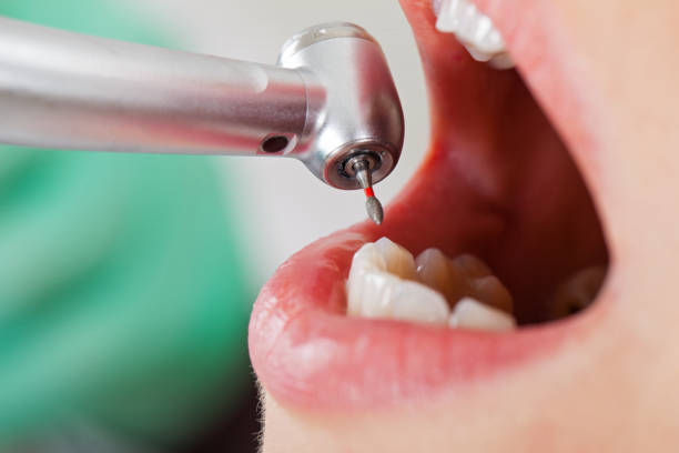 Best Broken or Cracked Tooth Emergency Dentist in Pennville, PA